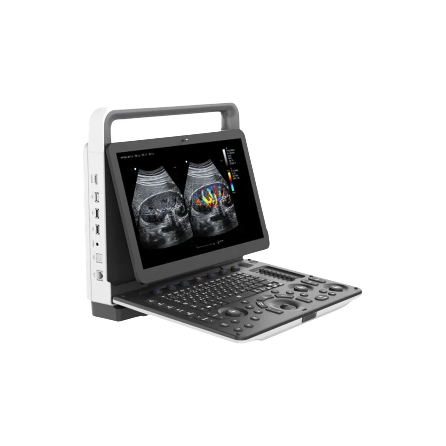 Zoncare Portable Color Doppler Ultrasound M30