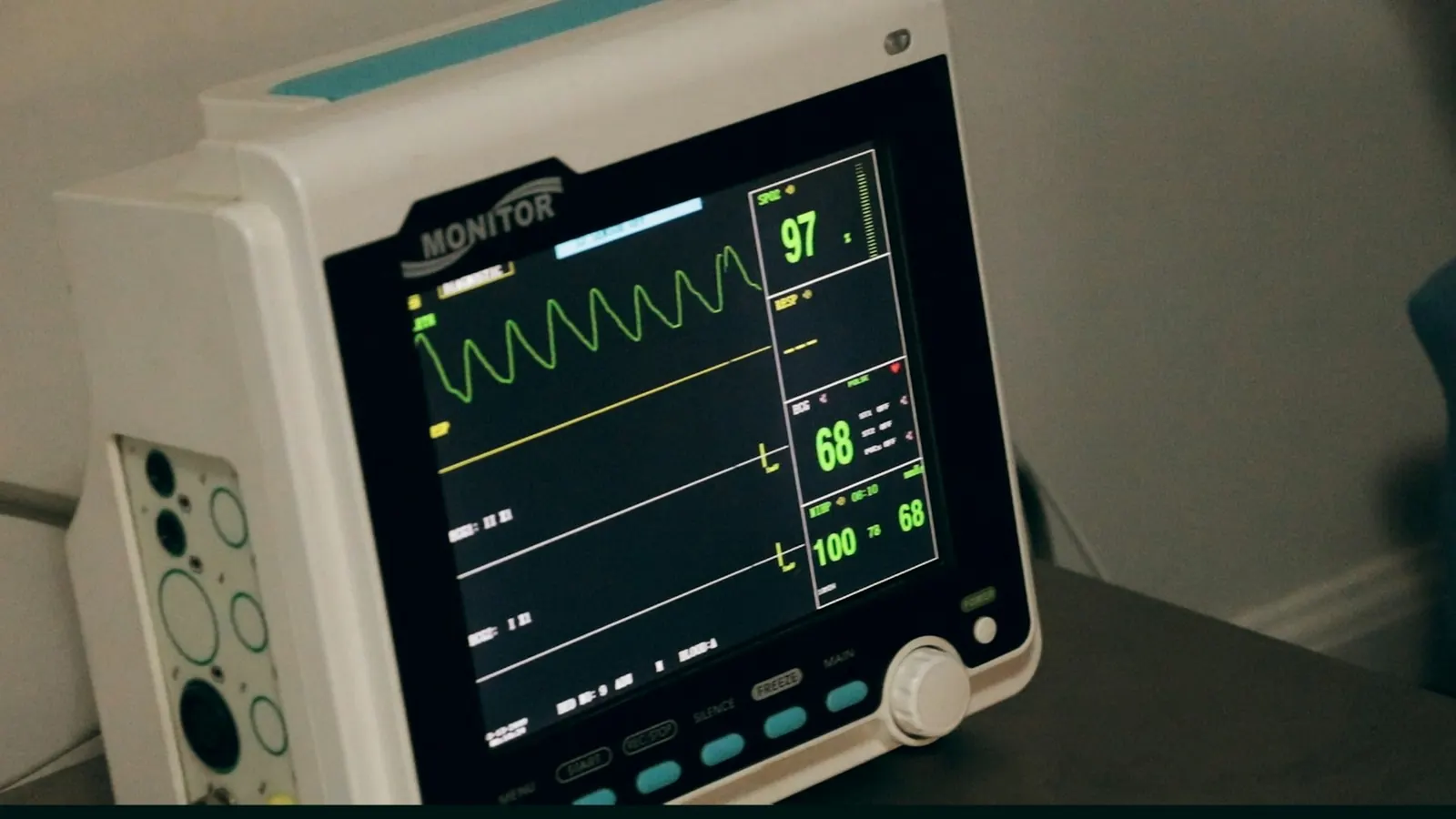A patient monitor displaying vital signs